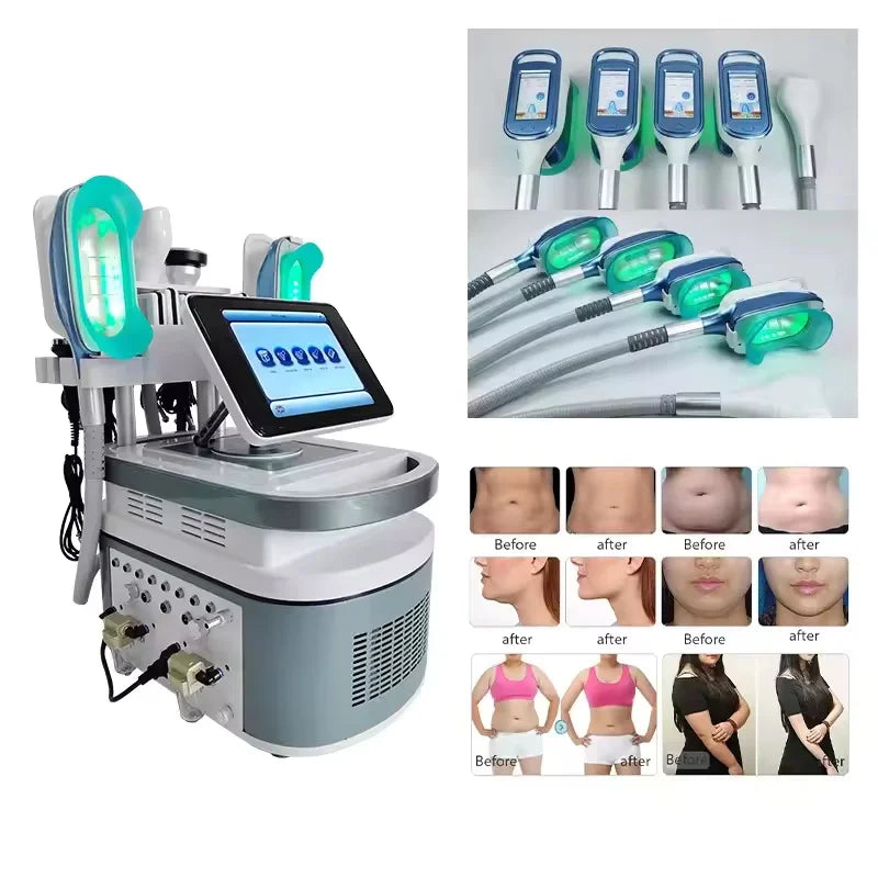 Portable 360 Cooling Sculpting Body Slimming Machine Loss Weight Fat Freezing 3 In 1 Cellulite Removal Vacuum Cavitation Machine